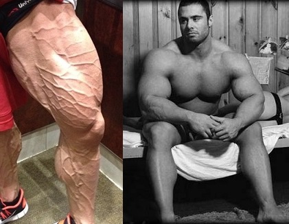 Vascularity steroids