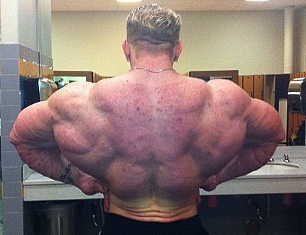 Steroids gone bad pics