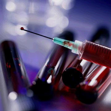 A Comprehensive Look at Lab Blood Tests | JuicedMuscle.com