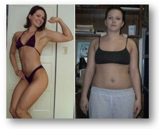 Before And After Photos Of Hcg Diet Patients Medical Center